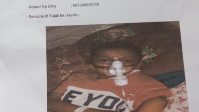 Pasien Bocor Jantung Dirujuk ke Jakarta, Butuh Bantuan Dermawan