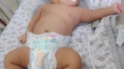 Kisah Pilu Bayi Penderita Jantung Bocor di Nagan Raya, Butuh Bantuan Dermawan dan Pemerintah