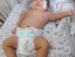Kisah Pilu Bayi Penderita Jantung Bocor di Nagan Raya, Butuh Bantuan Dermawan dan Pemerintah